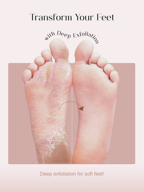 Seoulskin Glycolic Acid Foot Peeling Mask | Pack of 1
