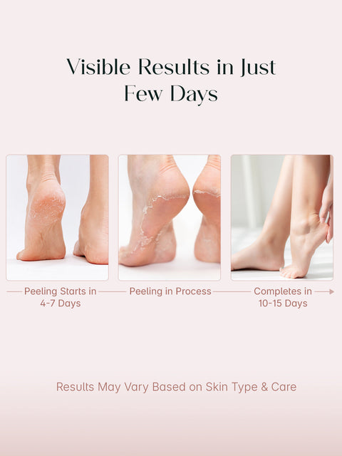 Seoulskin Glycolic Acid Foot Peeling Mask | Pack of 1